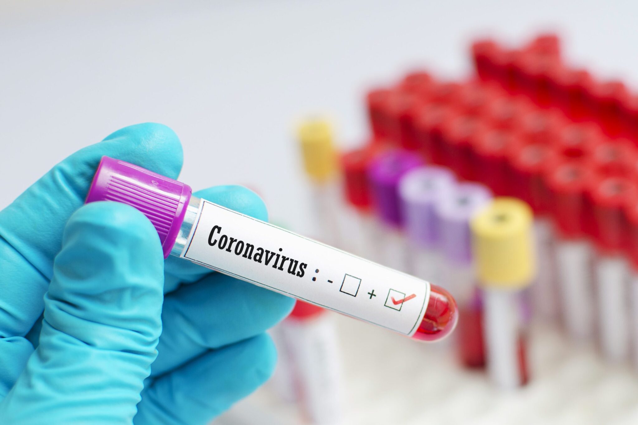 coronavirus scaled