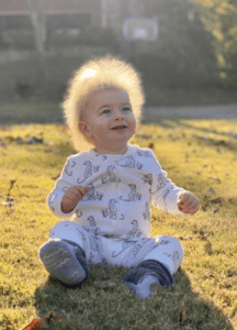 le syndrome des cheveux incoiffables en georgie le syndrome des cheveux incoiffables en georgie