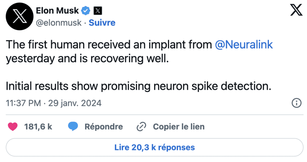 Neuralink